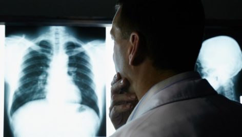 Doctor looking at xrays