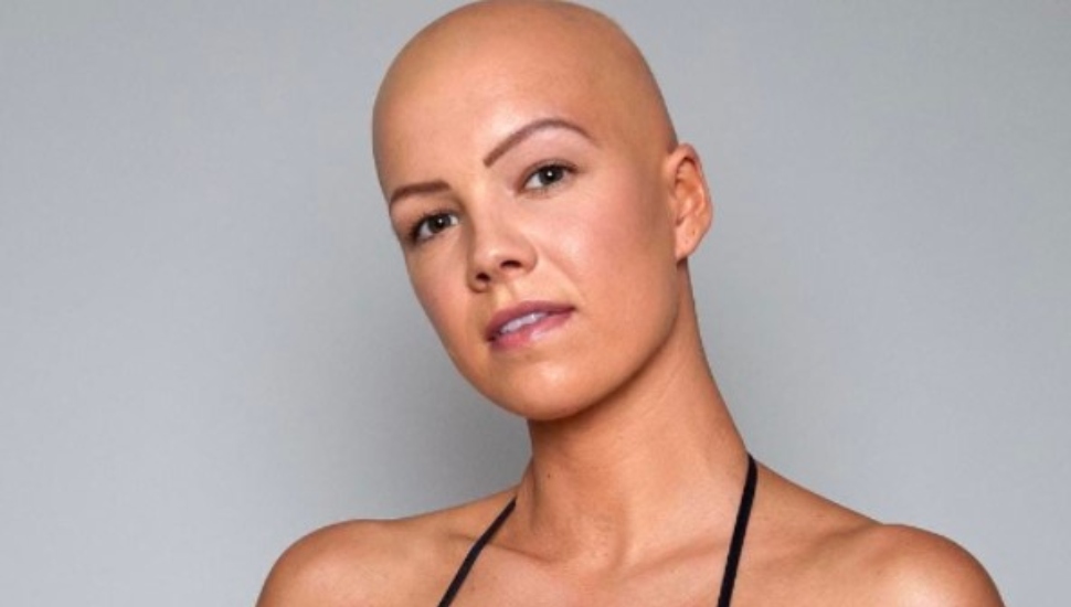 bald woman