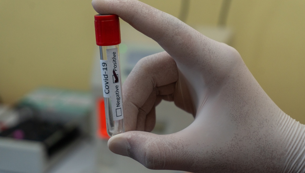 A hand holding a COVID test tube.