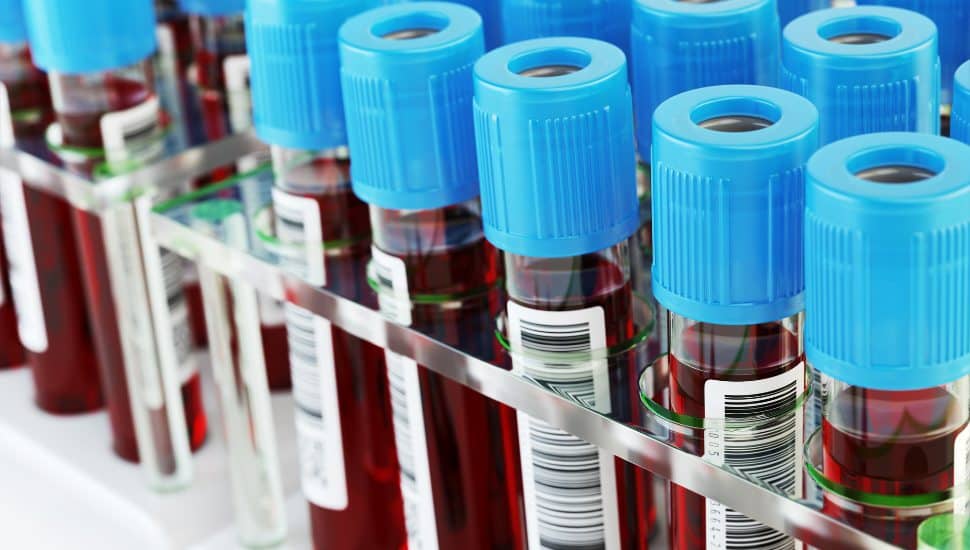 Vials of blood.