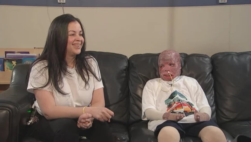 10-year -old Ramessess returns home after suffering severe burns when a medical jet crashed in Northeast Philadelphia.
